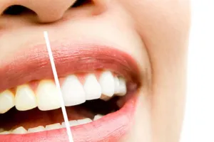 Bisa bantu putihkan, ini cara mengatasi gigi kuning hanya menggunakan 2 bahan dapur