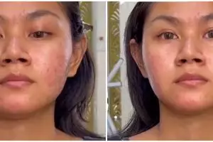 Gadis berkulit sawo matang dan bruntusan dirias MUA ala Korean look ini hasilnya flawless abis