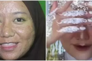 Transformasi wanita penuh bopeng dirias MUA jadi pengantin Sunda, wajah mulusnya manglingi