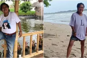 Bahagianya Suti Karno bisa jalan dengan bantuan kaki palsu usai diamputasi, tuai dukungan rekan seleb