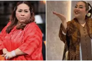 Kronologi Nunung Srimulat didiagnosa menderita kanker payudara, ada benjolan tak biasa