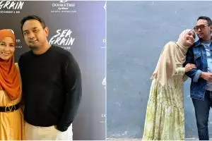 Alami pingsan dan pembengkakan, begini kisah Bebi Romeo jalani operasi pengangkatan kantong empedu