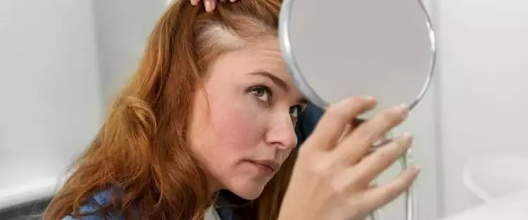 Dijamin ampuh, begini 8 cara atasi kulit kepala kering menggunakan bahan dapur