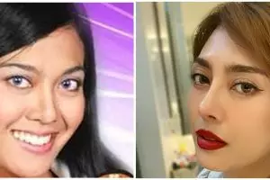 Wajahnya disebut makin glowing, ini beda penampilan 7 penyanyi sebelum vs sesudah operasi hidung