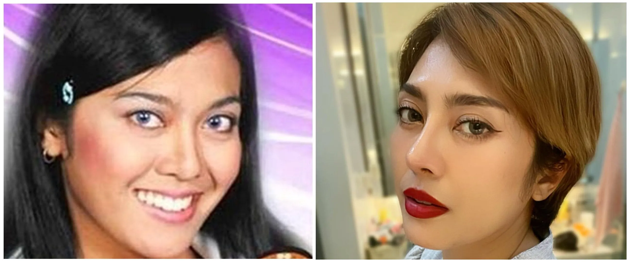 Wajahnya disebut makin glowing, ini beda penampilan 7 penyanyi sebelum vs sesudah operasi hidung