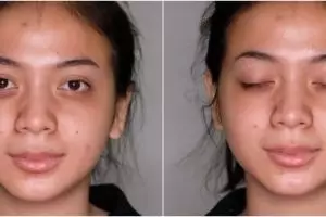 Wajah wanita dengan bekas jerawat dimakeup MUA ala Barbie, hasilnya bikin lupa paras aslinya