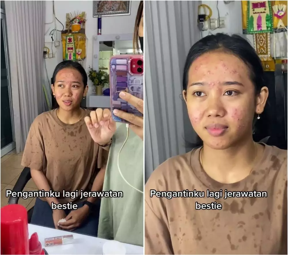 wanita berjerawat dirias pengantin bali © TikTok