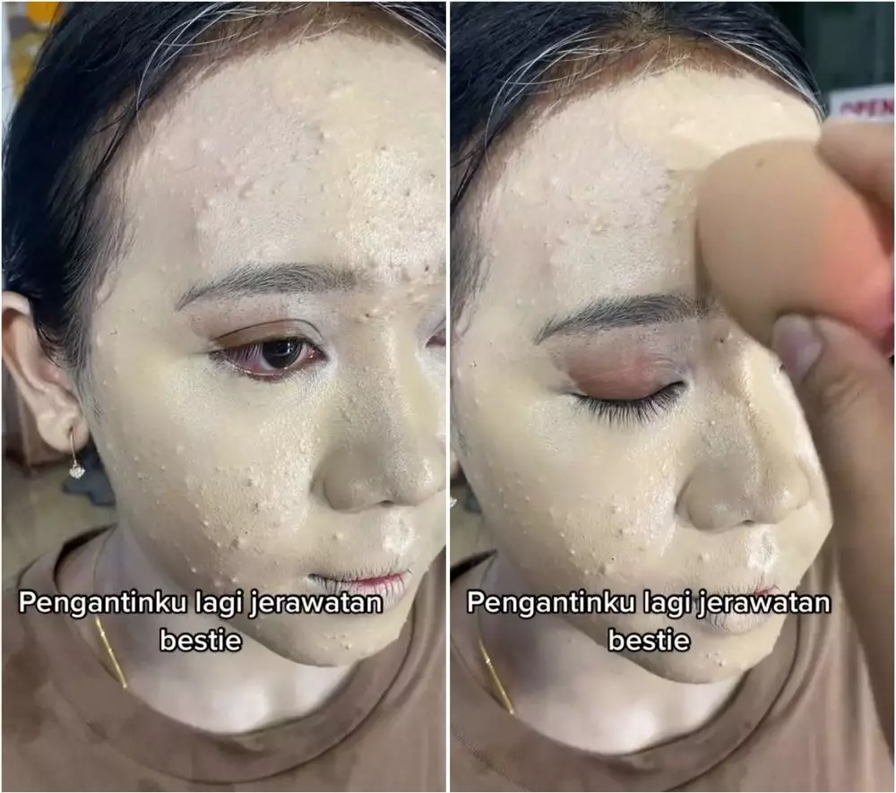 wanita berjerawat dirias pengantin bali © TikTok
