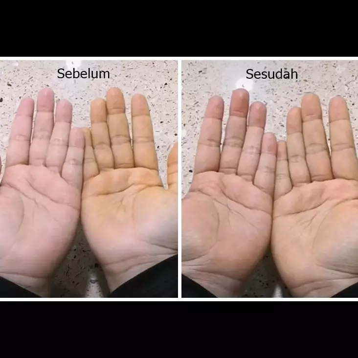 Bukan pakai sabun, begini cara praktis hilangkan noda kunyit di tangan pakai 1 bahan