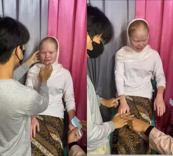 Transformasi wanita albino dirias MUA © TikTok Transformasi wanita albino dirias MUA © TikTok
