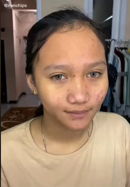 Gadis remaja ini dengan kulit berjerawat di make up MUA © 2023 brilio.net Gadis remaja ini dengan kulit berjerawat di make up MUA © 2023 brilio.net