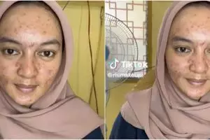 Wajah wanita penuh jerawat dirias MUA hasilnya jadi mirip Citra Kirana, bikin pangling