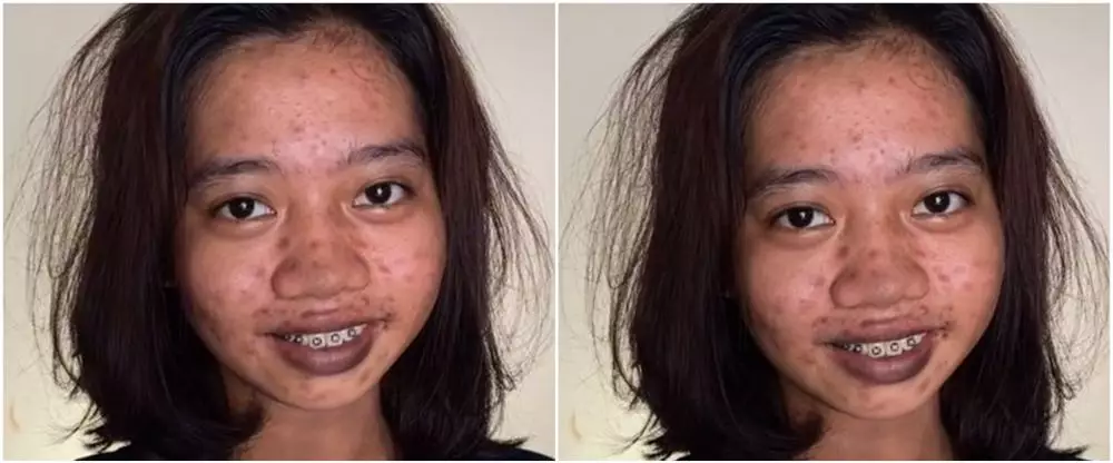 transformasi wanita dengan noda hitam © TikTok