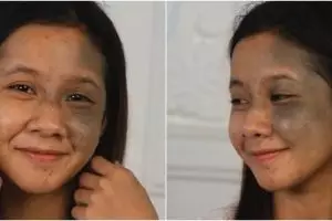 Transformasi makeup wanita punya bekas jerawat dan tompel setelah dirias MUA, hasilnya manglingi