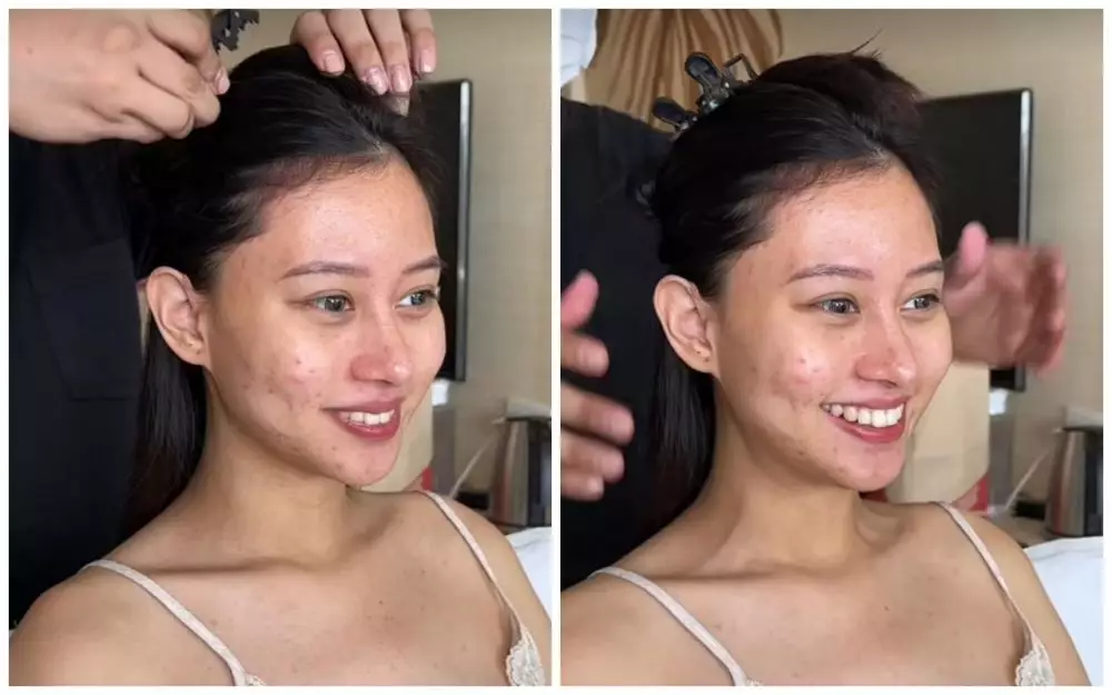 MUA hilangkan jerawat © Tiktok