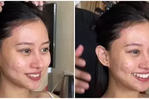 Pengantin wanita berjerawat dirias MUA jadi flawless bak idol K-Pop, hasilnya manglingi banget