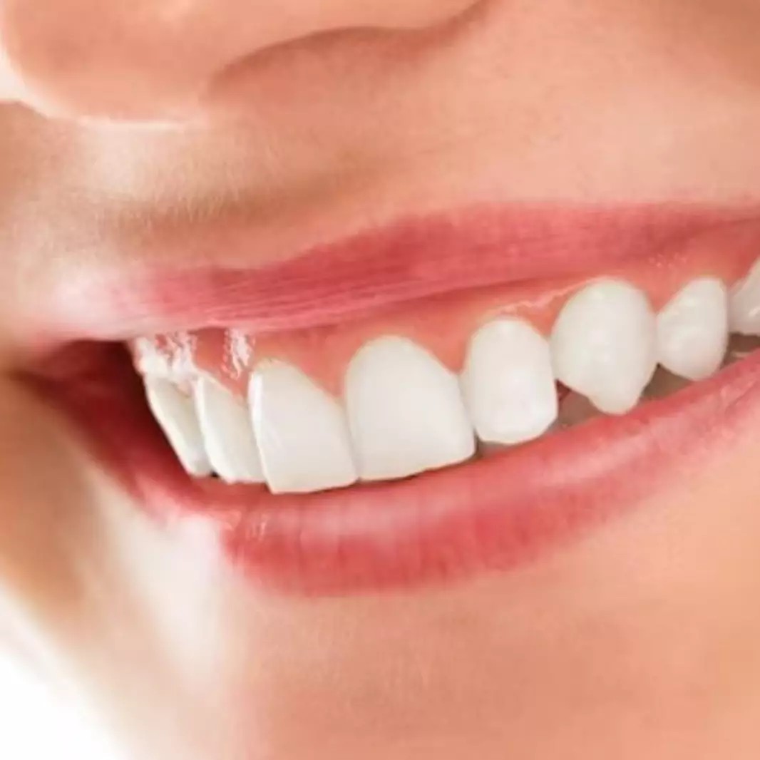 Cuma pakai 3 jenis buah, begini cara memutihkan gigi kuning secara alami