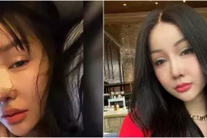 Penampilannya usai operasi hidung disorot, intip 11 transformasi Lucinta Luna yang manglingi