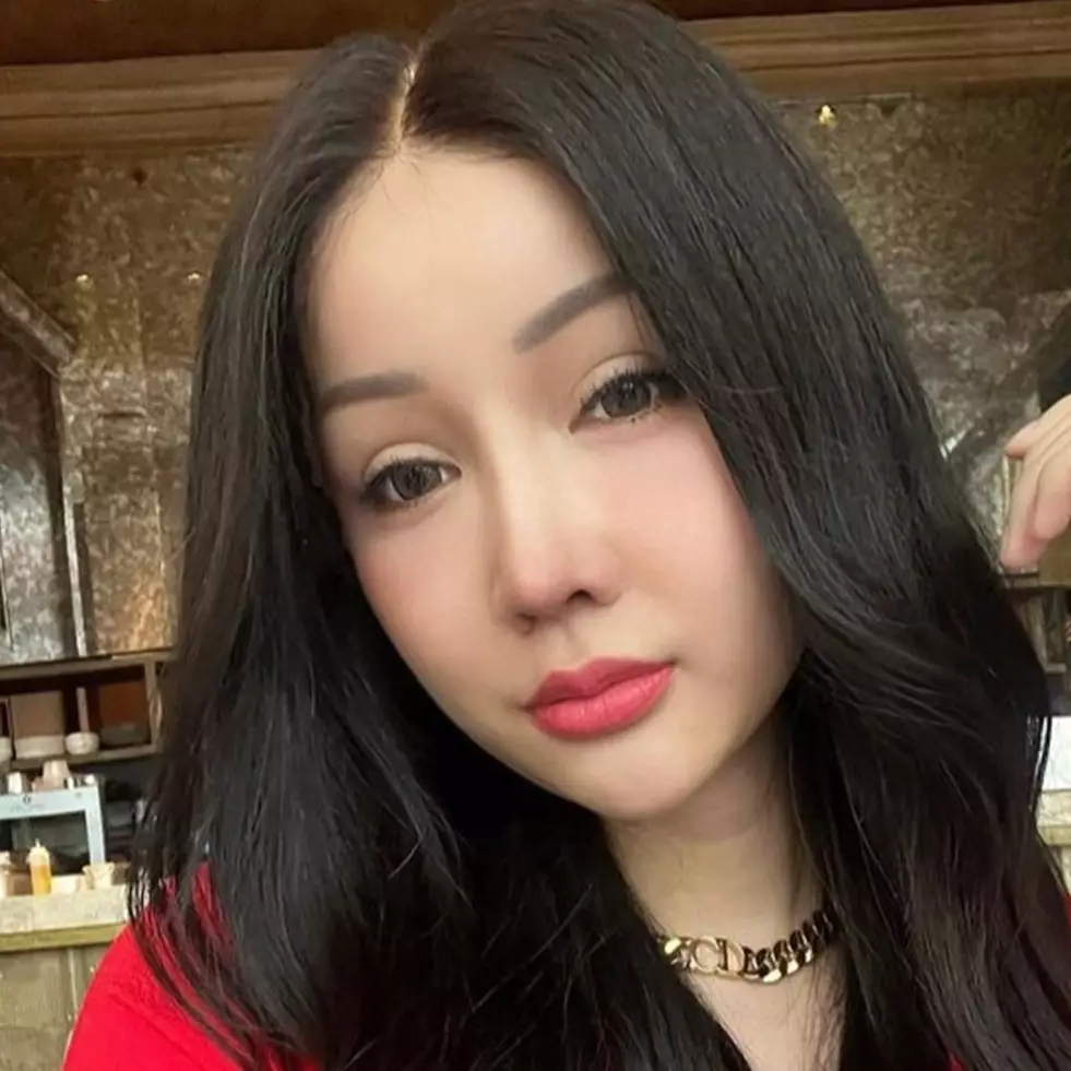 Penampilannya usai operasi hidung disorot, intip 11 transformasi Lucinta Luna yang manglingi