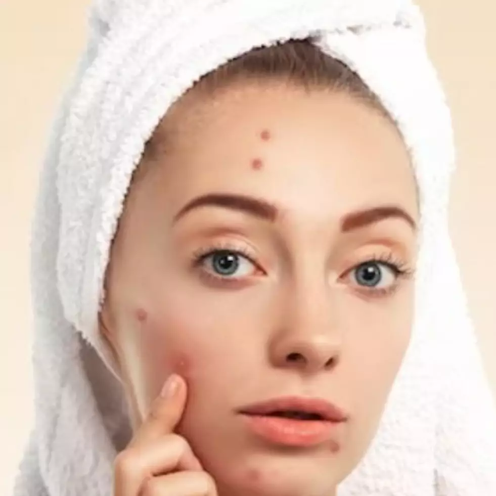 Bukan pakai color corrector, begini trik tutupi bekas jerawat dan flek dengan 2 produk makeup