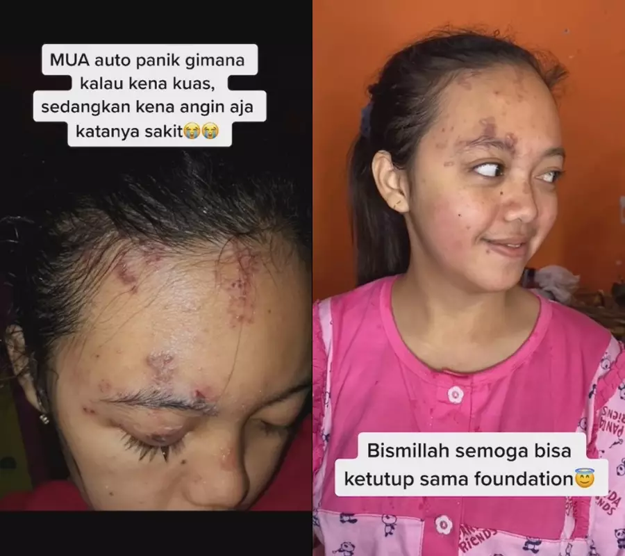 pengantin kena cacar api dirias MUA © TikTok/@vividwiwedding