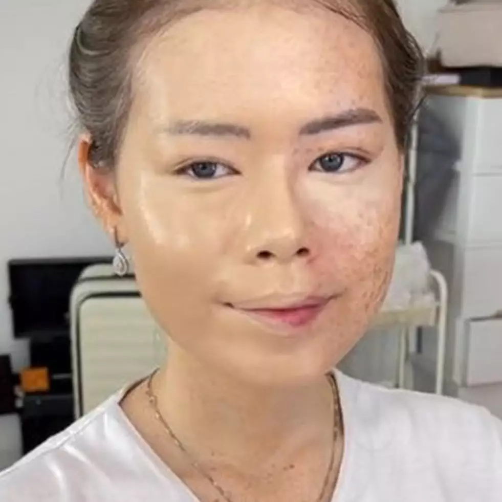 Wanita ini wajahnya penuh freckles dirias MUA ala makeup Korean look, transformasinya bak Barbie