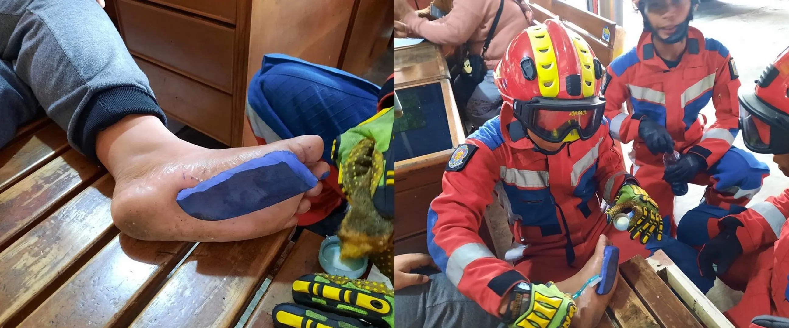 Dikerjai temannya pakai lem korea, kaki bocah ini nempel di sandal dan harus ditangani petugas Damkar