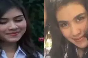 Dituduh operasi plastik oleh warganet, 11 potret dulu dan kini Syahnaz Sadiqah ini bikin pangling