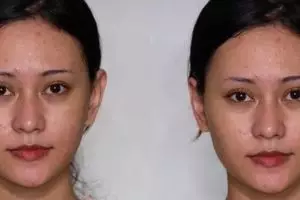 Transformasi cewek kulit berjerawat dirias MUA jadi pengantin ini manglingi banget, bak barbie hidup