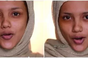 Transformasi makeup cewek kulit sawo matang berjerawat jadi flawless banget, hasilnya bak Barbie hidup