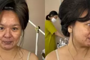Wanita paruh baya dengan kulit kusam dan flek hitam di makeup MUA, hasilnya bak ABG