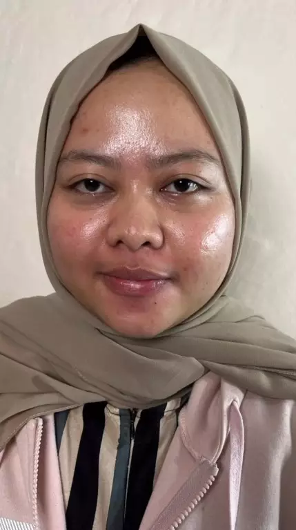 Wanita dengan wajah berminyak dirias MUA © Instagram