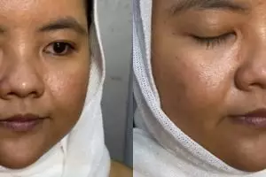 Punya kulit kusam, pengantin wanita dimakeup ala Korea ini penampilannya bikin lupa wajah aslinya