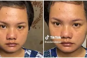 Wanita berkulit beruntusan dimakeup MUA jadi pengantin Batak, hasilnya manglingi banget