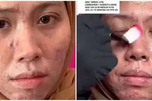 Wanita berwajah gradakan ini dirias MUA jadi pengantin modern, hasilnya bikin pangling