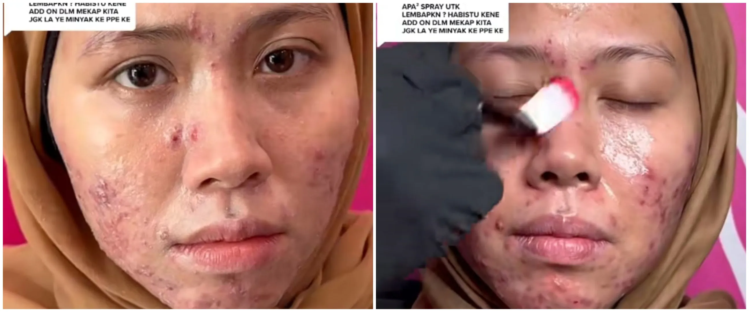 Wanita berwajah gradakan ini dirias MUA jadi pengantin modern, hasilnya bikin pangling