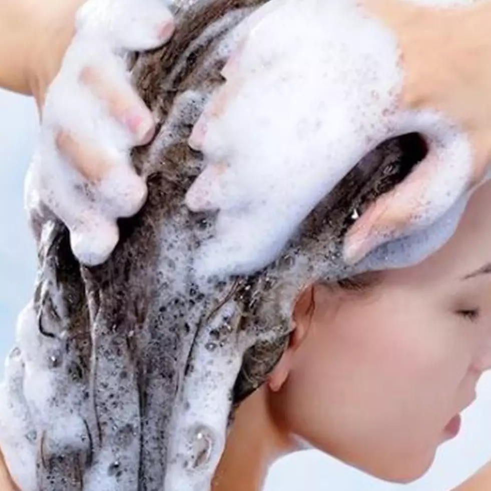 Cegah ketombe datang lagi, begini rutinitas keramas yang benar agar rambut tetap sehat
