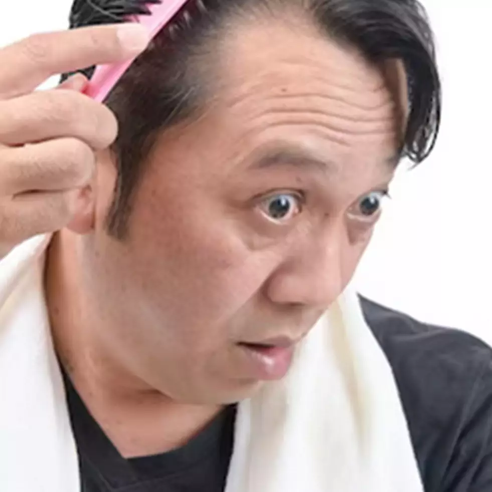 Hanya pakai 2 bumbu dapur, begini cara membuat hair mask untuk atasi rambut pitak agar kembali tumbuh