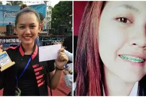 6 Potret Happy Asmara sebelum dan sesudah perawatan gigi, penampilannya bikin gagal fokus