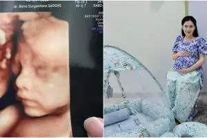 7 Momen Nella Kharisma melahirkan anak kedua secara normal, paras sang buah hati bikin penasaran