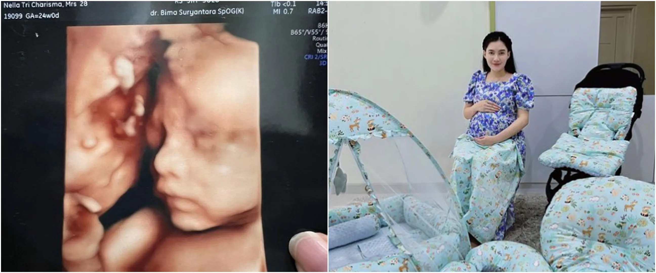 7 Momen Nella Kharisma melahirkan anak kedua secara normal, paras sang buah hati bikin penasaran