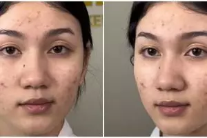 Wanita berjerawat dimakeup ala pengantin China, hasilnya plek-ketiplek Ariel Tatum