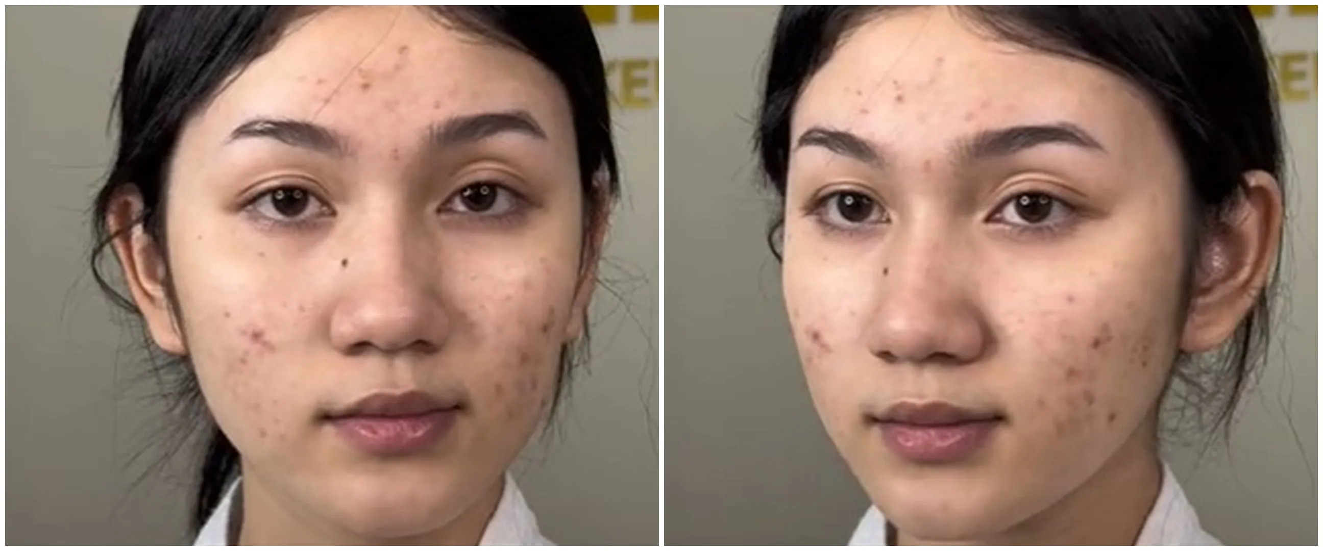 Wanita berjerawat dimakeup ala pengantin China, hasilnya plek-ketiplek Ariel Tatum