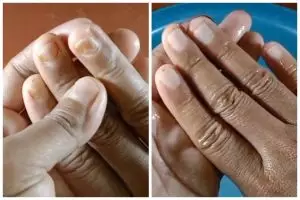 Cuma pakai satu bahan, ini cara hilangkan noda getah jantung pisang yang membandel di kuku tangan