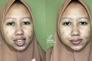 Perubahan wanita usai makeup sendiri ini bikin takjub, bekas jerawat autohilang dan mulus tanpa celah