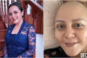 Kini tampil dengan kepala plontos, Cinta Ramlan ceritakan perjuangan hidup usai divonis kanker serviks
