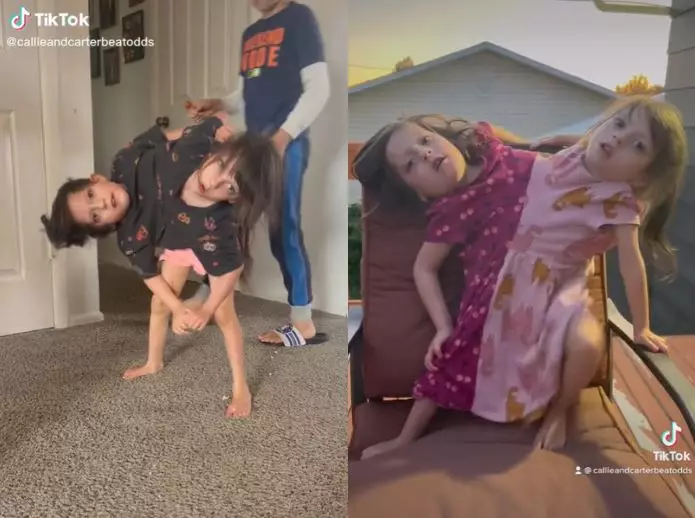 ibu beranak kembar siam TikTok