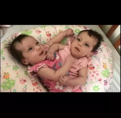 ibu beranak kembar siam TikTok