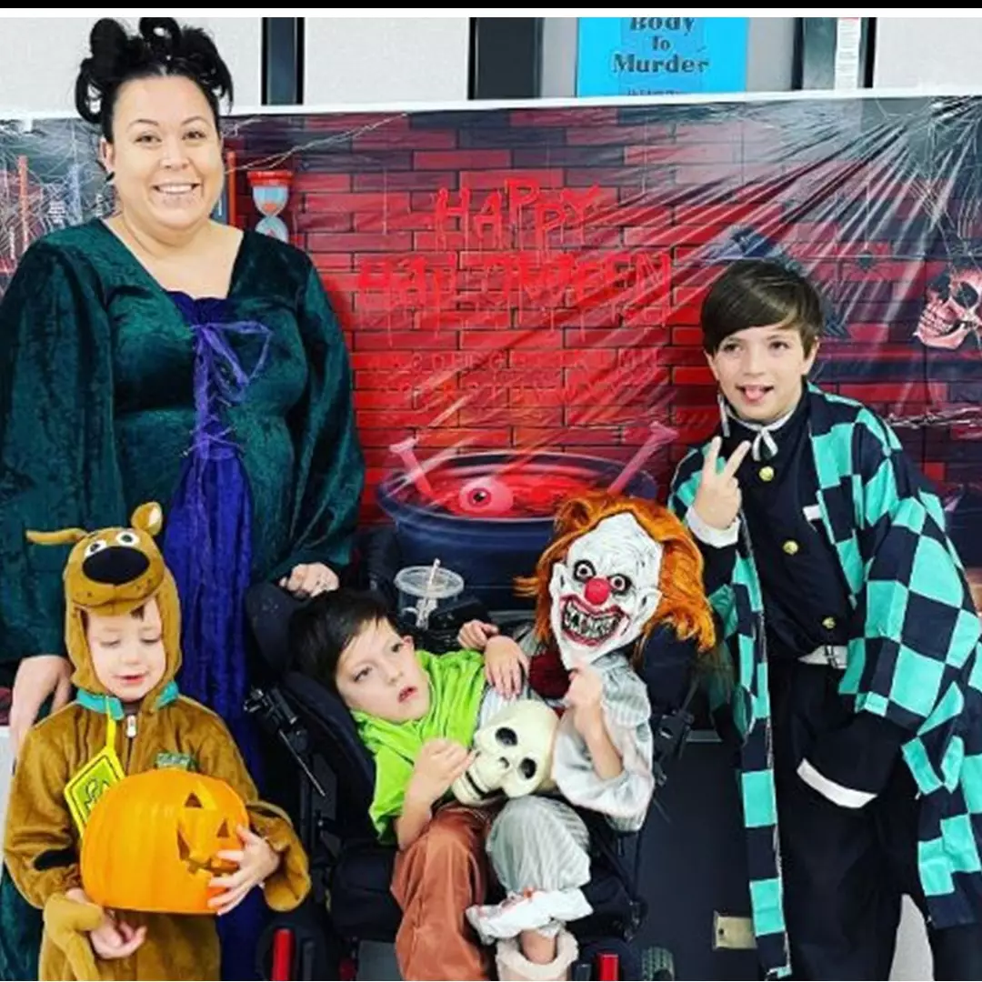 Kisah heroik ibu beranak kembar siam ini bikin salut, sempat ingin digugurkan dokter tapi ditolak