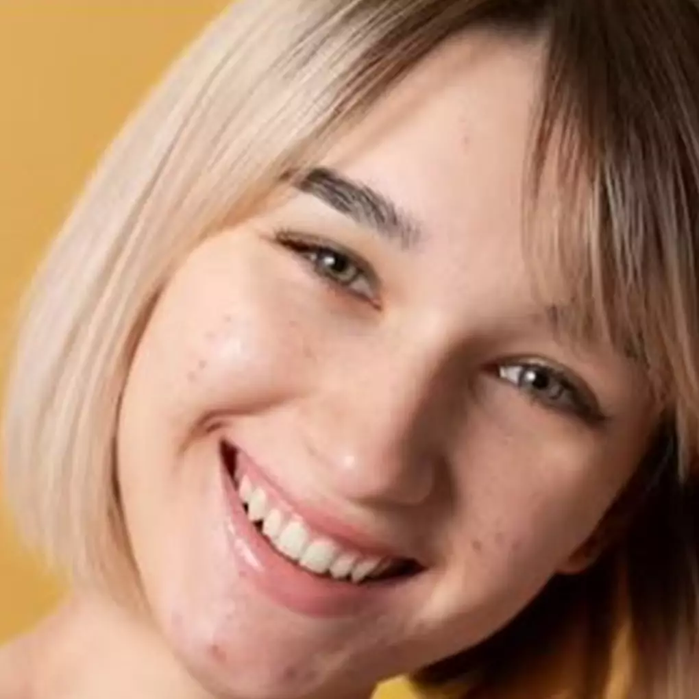 Cara atasi kulit kering dengan masker wajah dari 1 buah ini bikin auto lembap dan kenyal